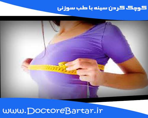 کوچک کردن سینه با طب سوزنی