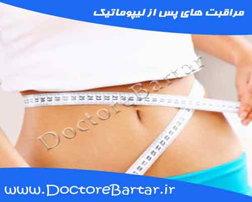 مراقبت های پس از لیپوماتیک