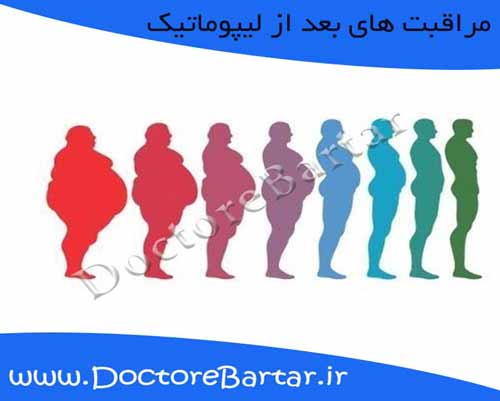 مراقبت های بعد از لیپوماتیک