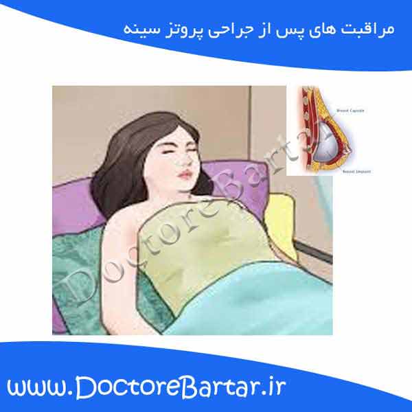 پروتز سینه