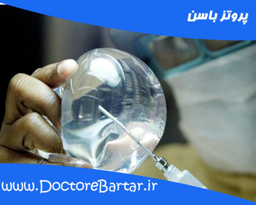 پروتز باسن