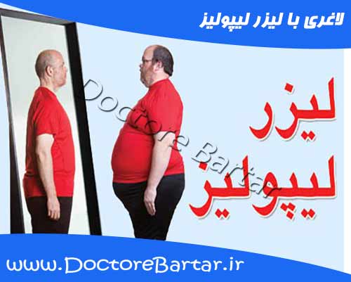 لیزر لیپولیز چیست ؟