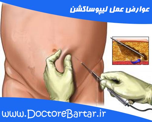 ویژگی بینی زیبا