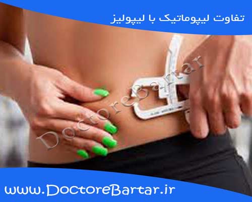 تفاوت لیپوماتیک با لیپولیز