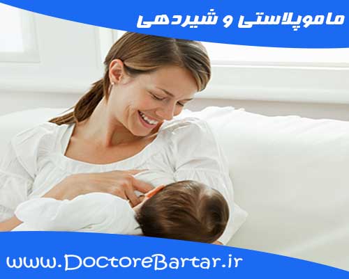 ماموپلاستی و شیردهی