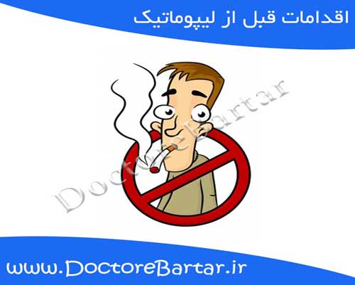 اقدامات قبل از لیپوماتیک