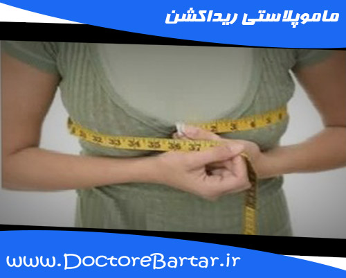 ماموپلاستی ریداکشن