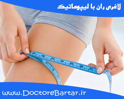 لاغری ران با لیپوماتیک