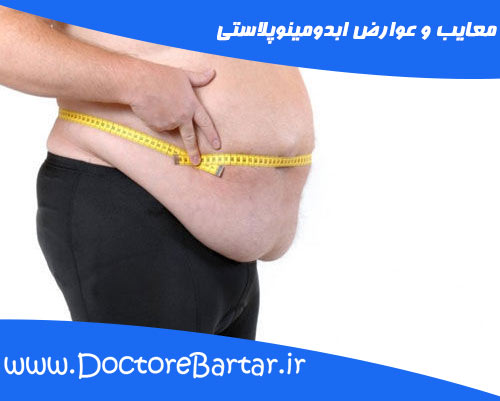 عوارض ابدومینوپلاستی