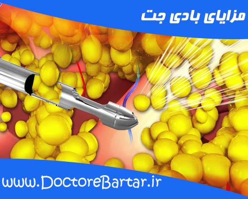 مزایای بادی جت