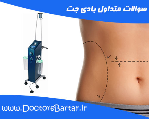 سوالات متداول بادی جت
