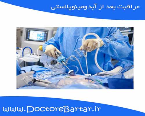 مراقبت بعد از آبدومینوپلاستی