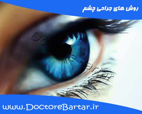 روش های جراحی چشم