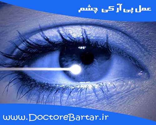 پی آر کی