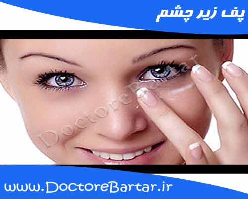 درمان پف زیر چشم