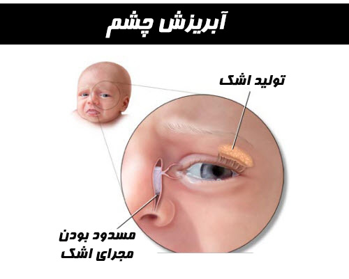 اشک ریزش