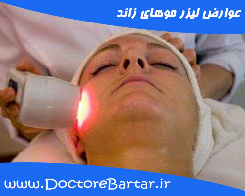 عوارض لیزر موهای زائد