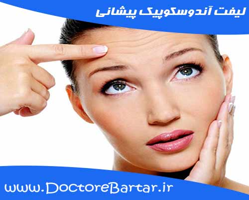 لیفت آندوسکوپیک پیشانی