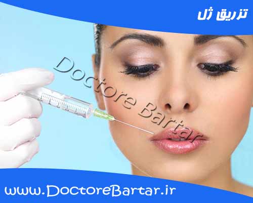 تزریق ژل