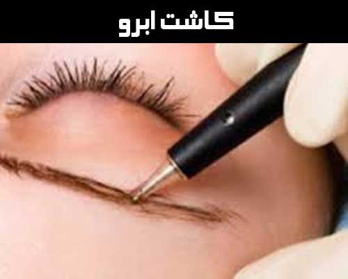 کاشت ابرو