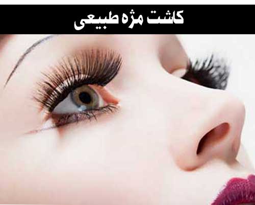 کاشت مژه