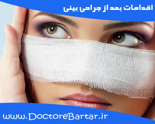 اقدامات بعد از جراحی بینی