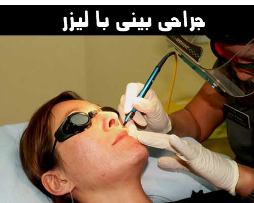 جراحی بینی با لیزر