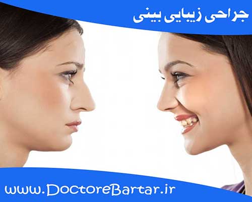 جراحی بینی