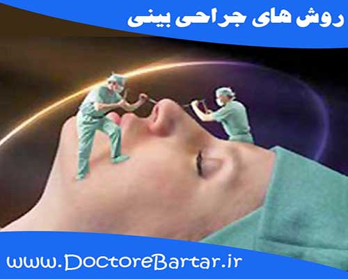 روش های جراحی بینی