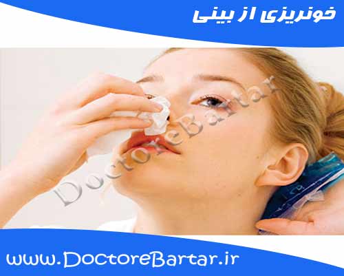 خونریزی بعد از جراحی بینی