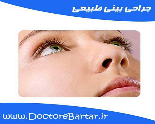 جراحی بینی