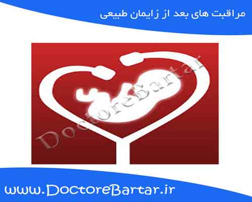 مراقبت های بعد زایمان طبیعی