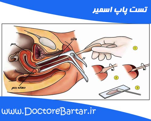 پاپ اسمیر