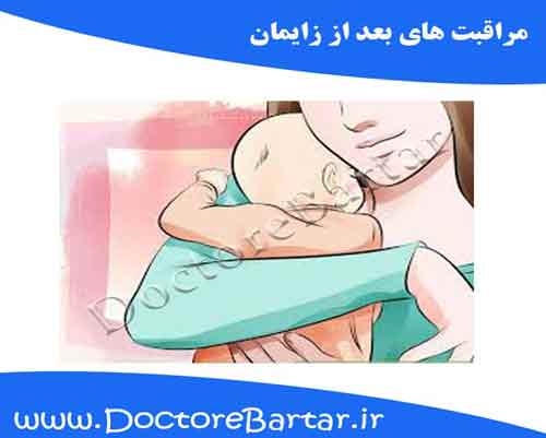 مراقبت های بعد از زایمان