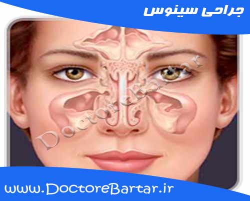 جراحی سینوس
