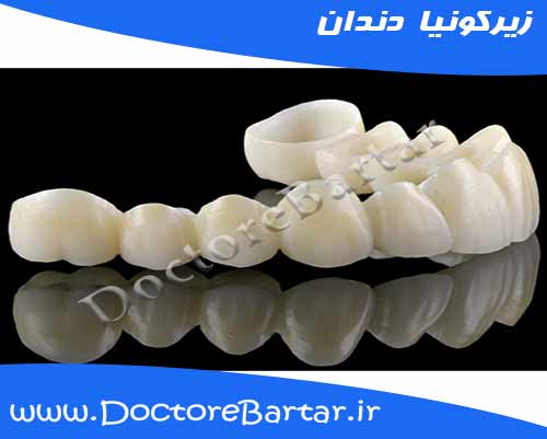 زیرکونیا دندان
