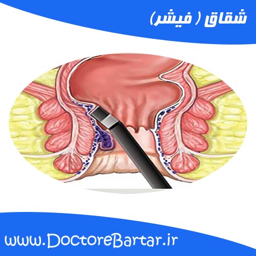 شقاق